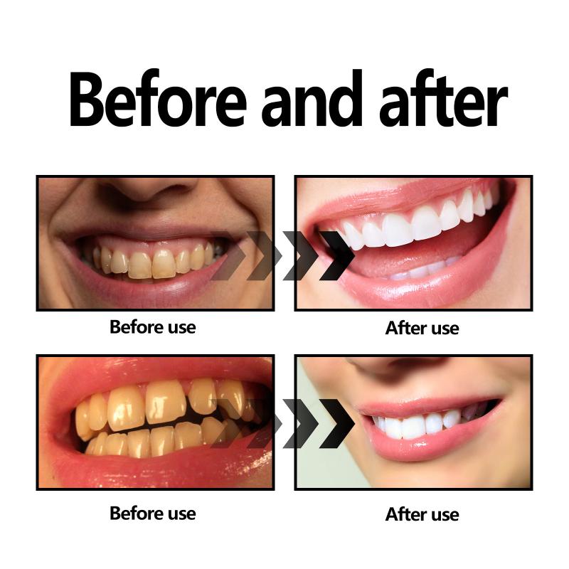 Teeth Whitening Powder Charcoa - Teeth Whitening Filter ulasan dan harga