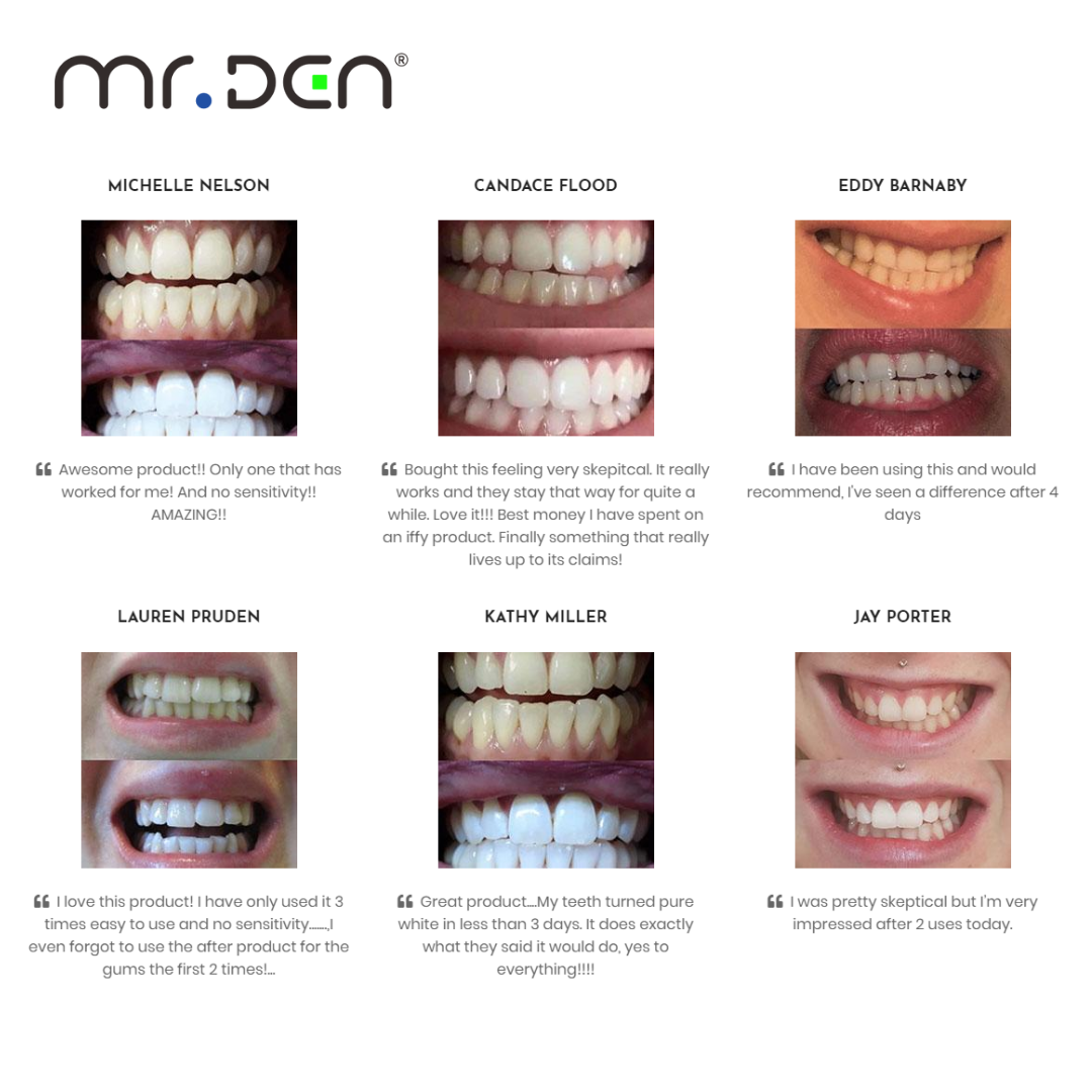Dr. Whiten 3 Pack Teeth Whiten - Teeth Whitening China ulasan dan harga