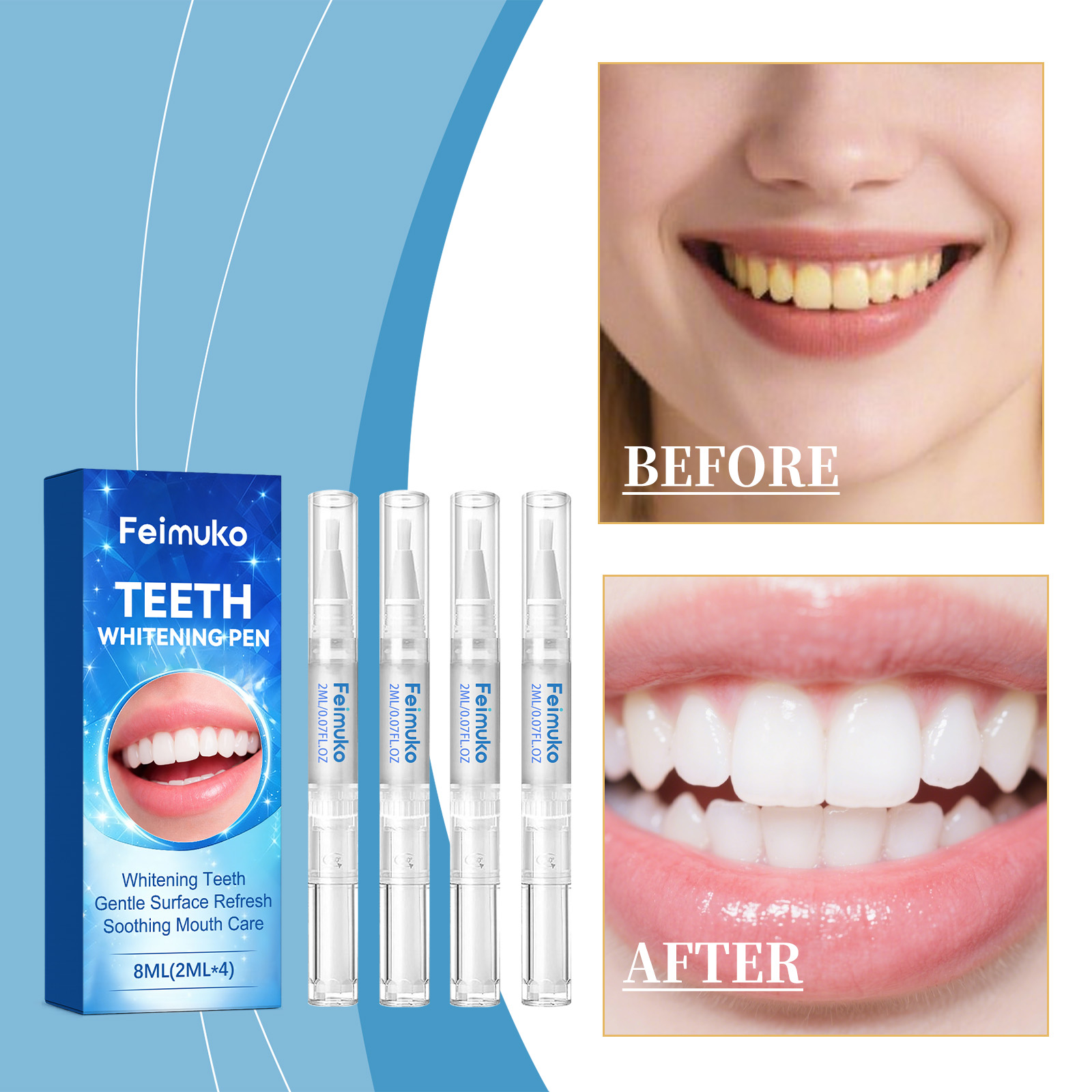 Feimuko 8ml Teeth Gel Pen Gent - Teeth Whitening Singapore ulasan dan harga