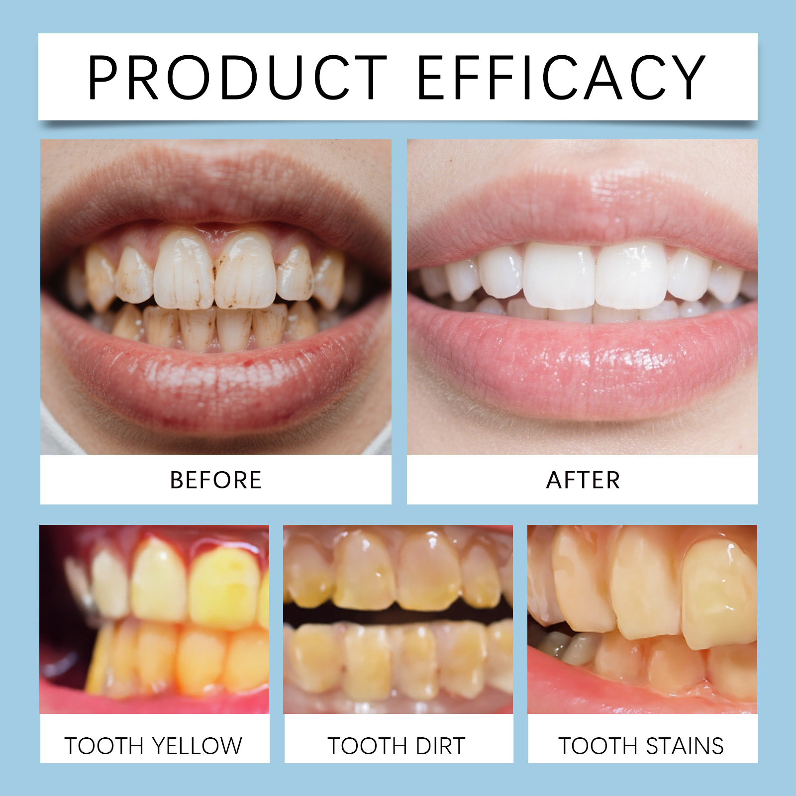Feimuko 8ml Teeth Gel Pen Gent - Teeth Whitening Singapore ulasan dan harga