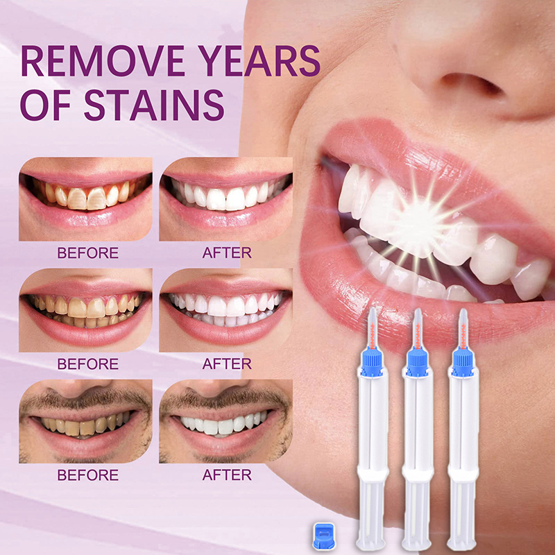 Dental Clinic Dual Barrier Syr - Teeth Whitening Gel Syringes ulasan dan harga