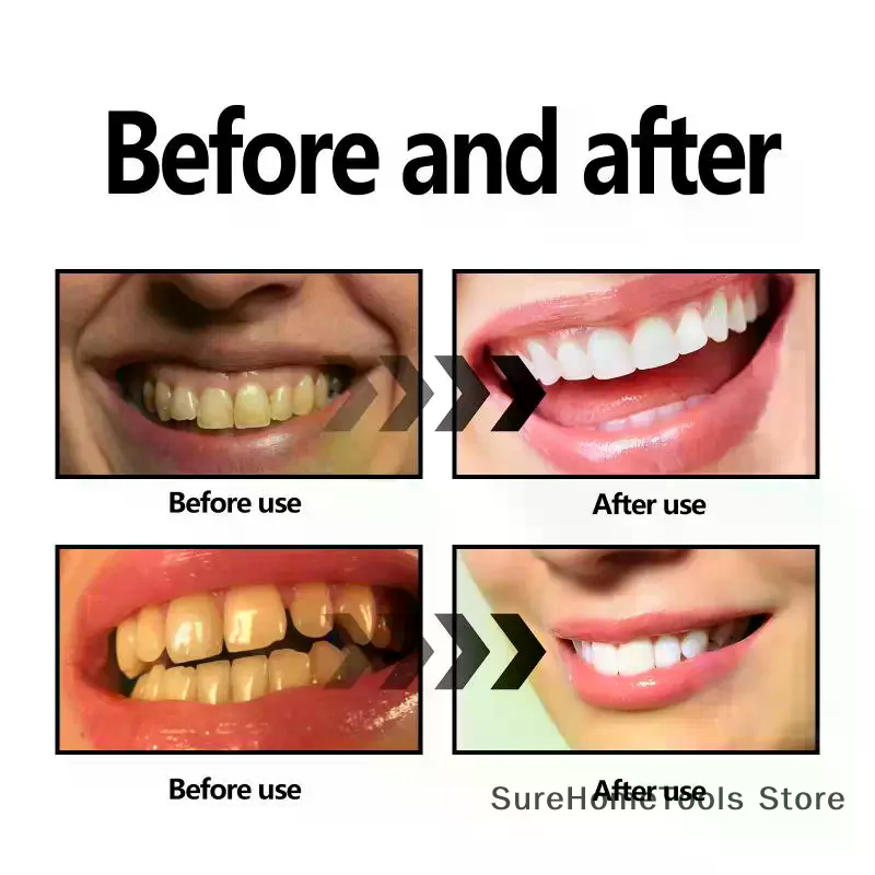 Bamboo Charcoal Powder For Tee - Teeth Whitening China ulasan dan harga