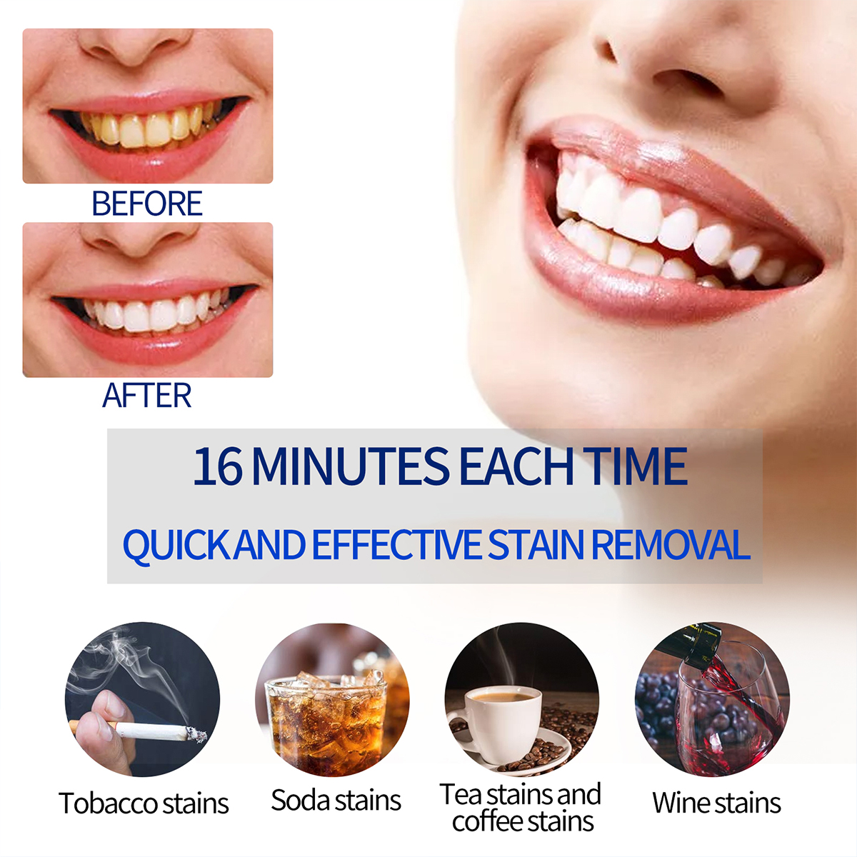Portable Teeth Whitening Lamp  - Teeth Whitening Singapore ulasan dan harga